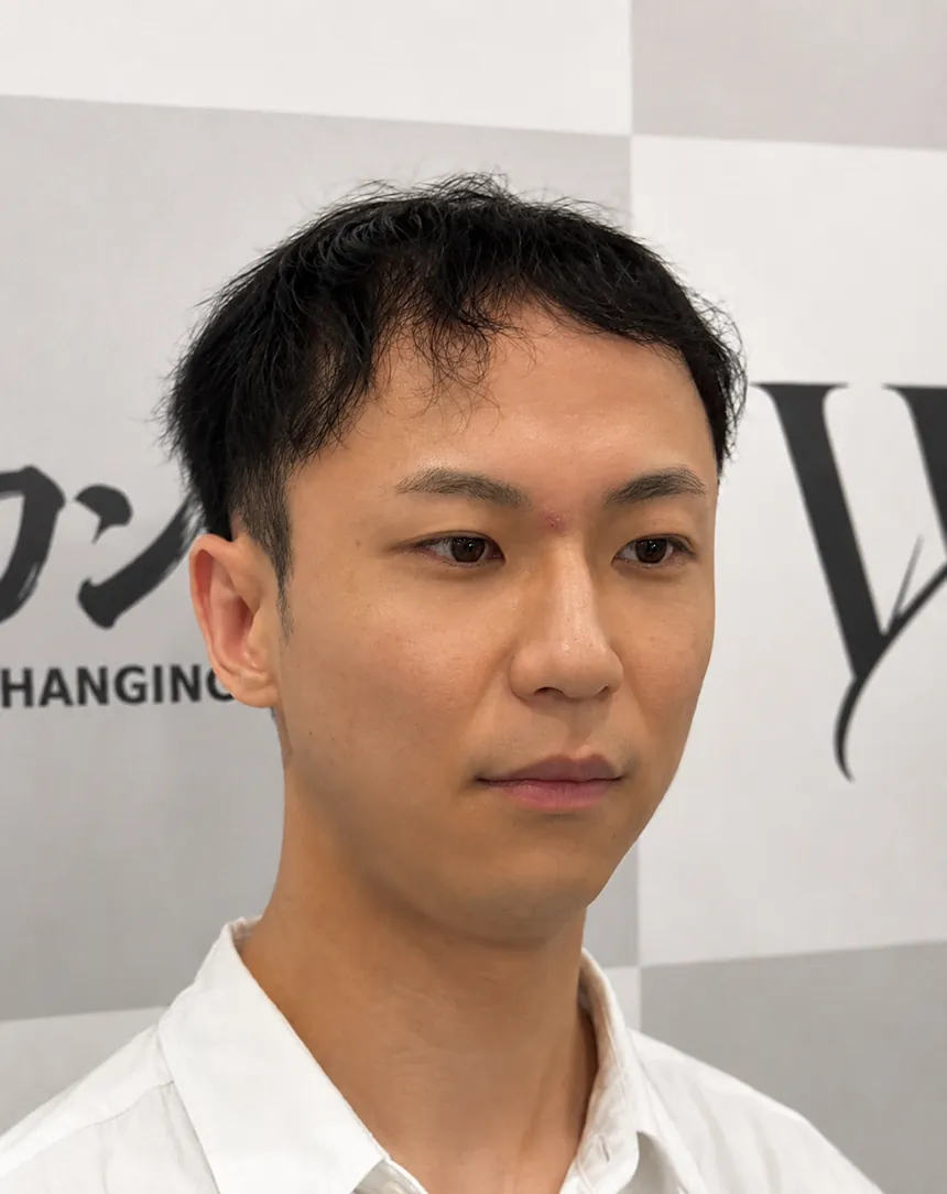 着用前